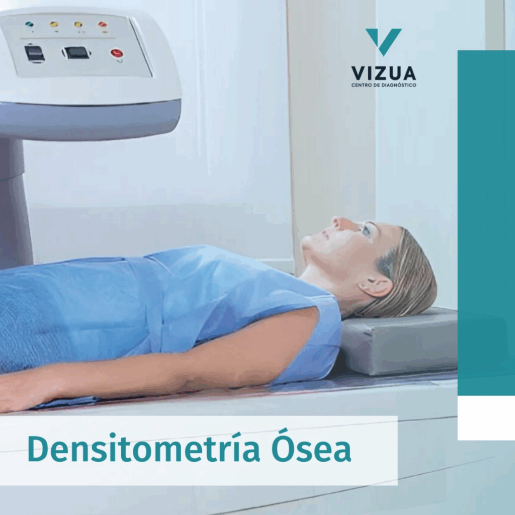 La densitometría óesa es el examen ideal para diagnosticar y monitorear la osteopenia y osteoporosis.